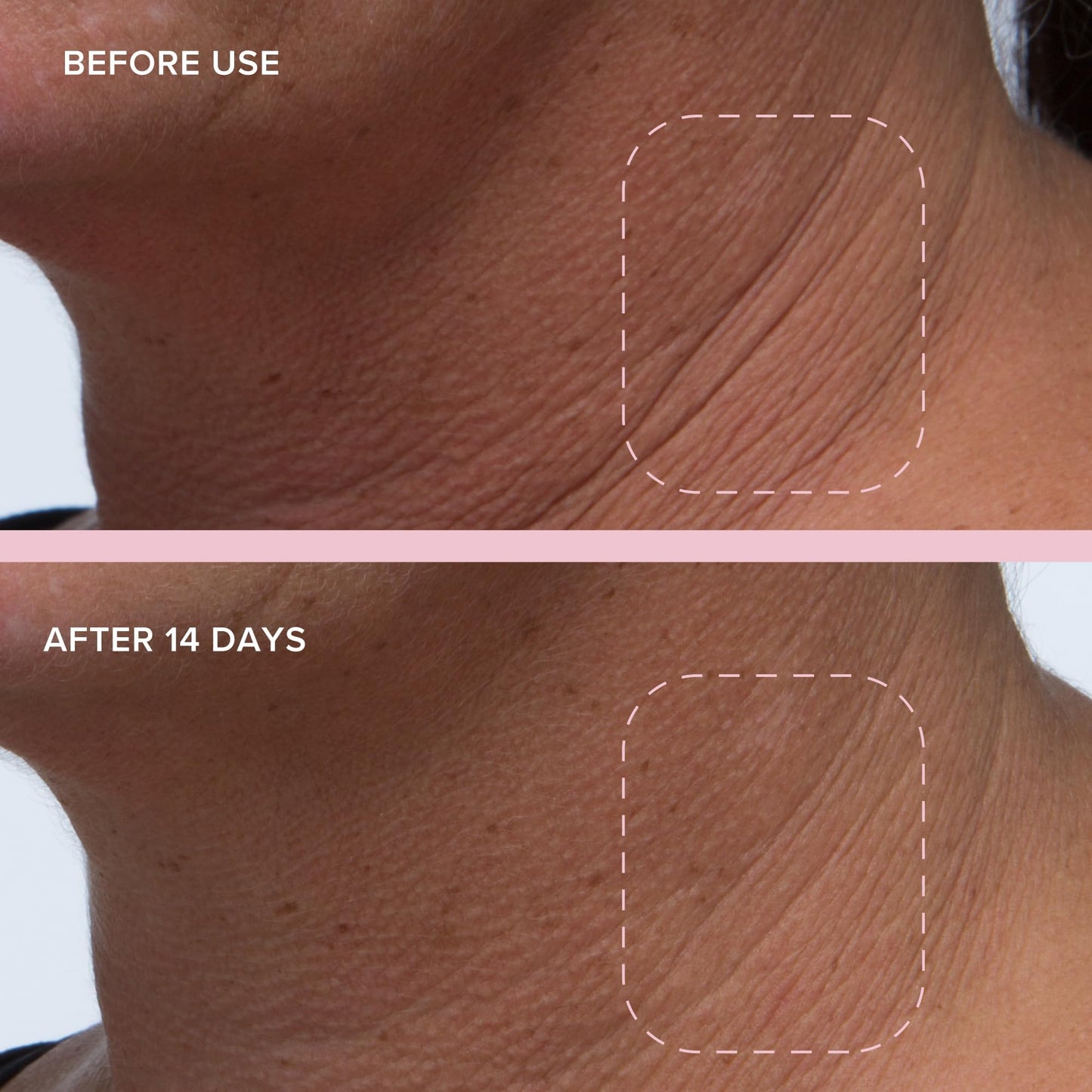 Alpyn Plant-Genius Melt Moisturizer | Staff-Picked Best Source of Bakuchiol 1.7 oz / 50 ml