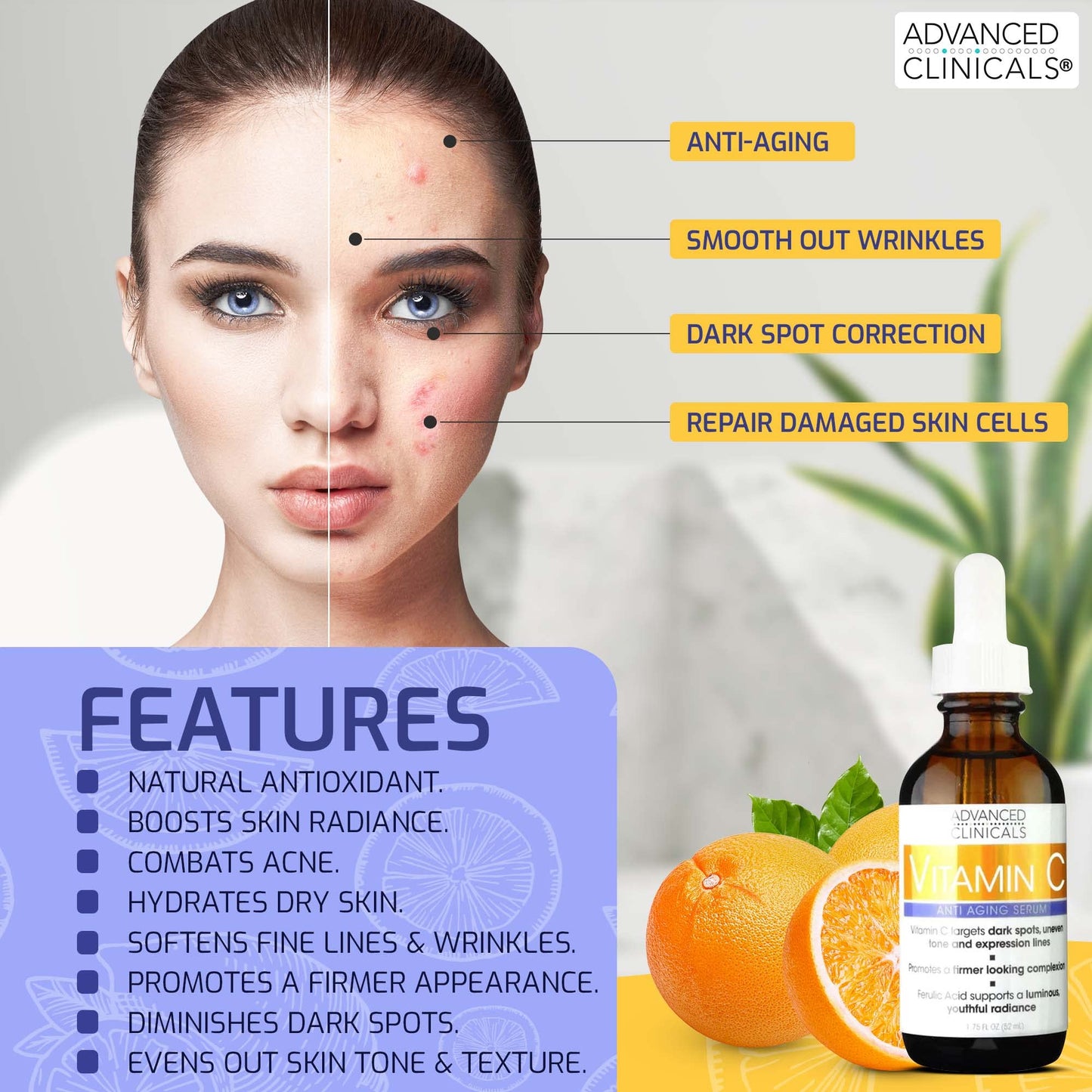 Advanced Clinicals Niacinamide Serum - 5% Niacinamide Serum For Face W/Hyaluronic Acid Serum, Ferulic Acid, Aloe Vera, Fruit Extracts - Dark Spot & Age Spot Remover - Skin Serum for Face 1.75 Fl Oz