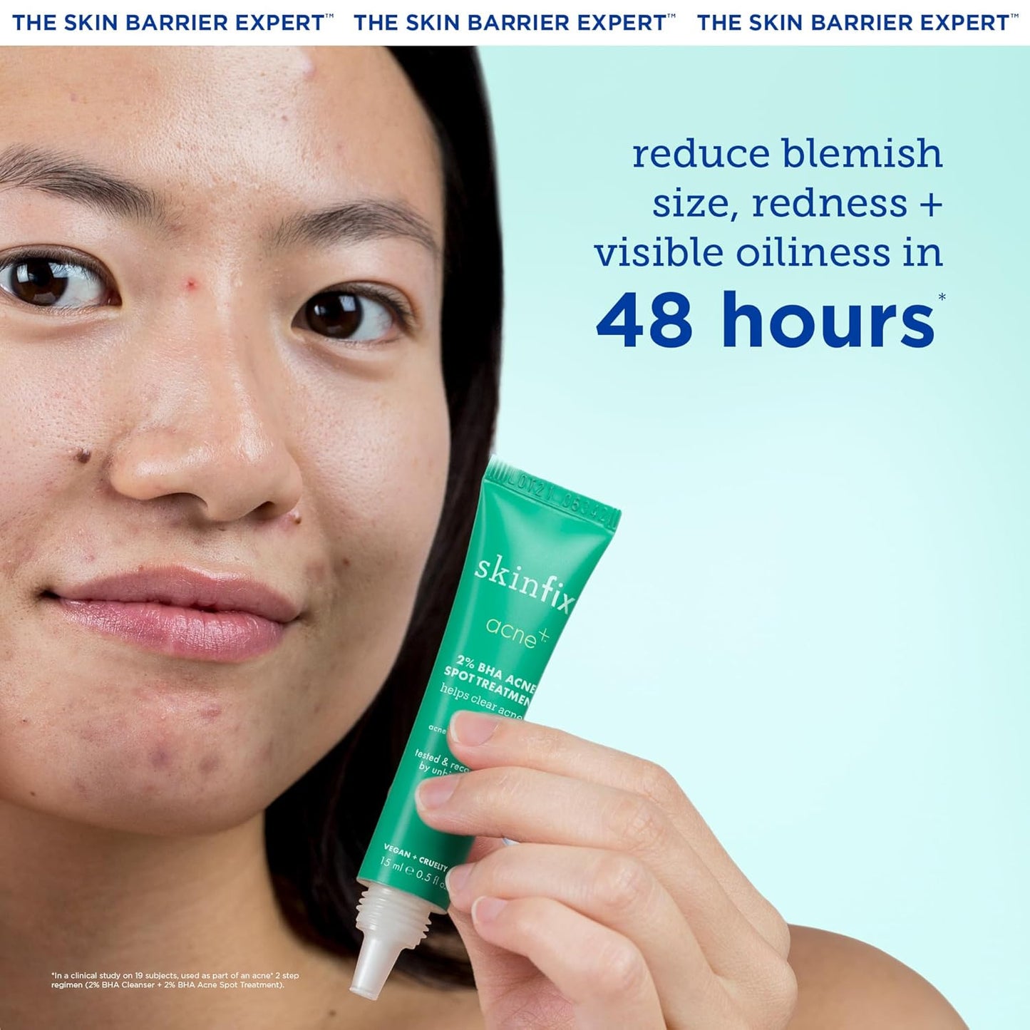 Skinfix Acne+ Gentle 2% Active Acne Spot Facial Treatment: Clinical-Strength, Acne Treatment that Nourishes & Reduces Blemish Size and Redness, Discourages New Acne Growth, 0.5 oz